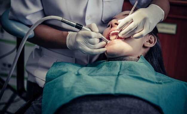 Какие симптомы сопровождают абсцесс зуба?
