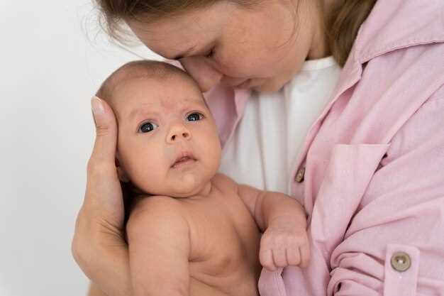 Акне новорожденных: причины, симптомы, лечение