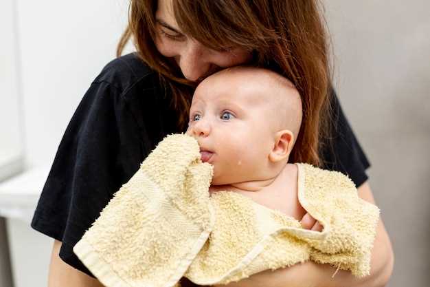 Лечение акне у новорожденных