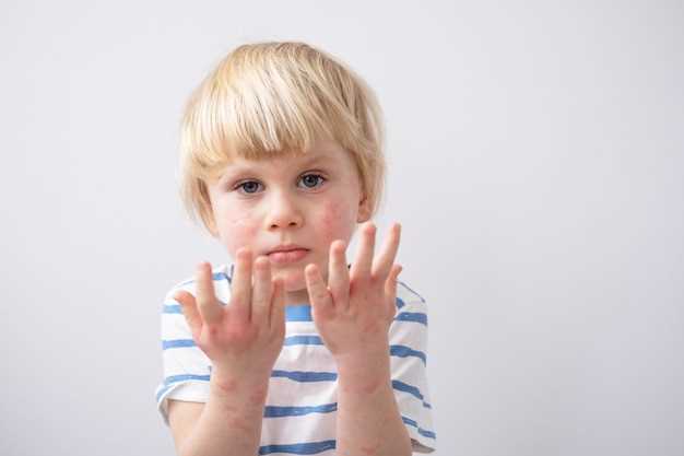 Советы по уходу за кожей пальцев рук ребенка