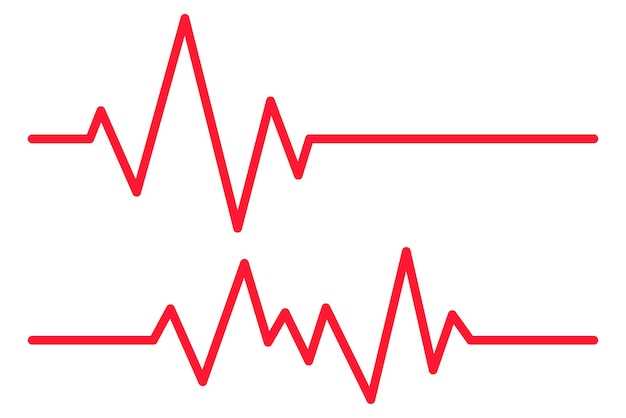 Значение ЭКГ в диагностике сердечных заболеваний