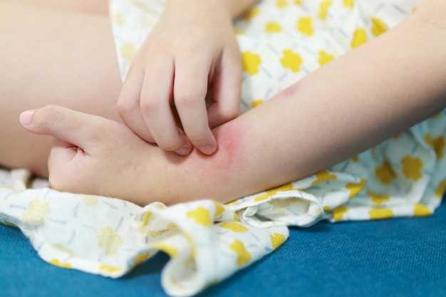 Лечение кожных заболеваний у детей