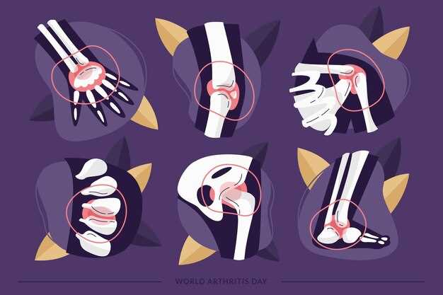 Симптомы переломов костей