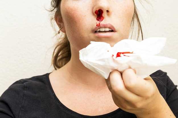Возможные причины носовых кровотечений во время беременности