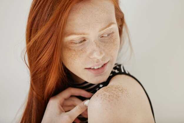 Способы решения проблемы шелушения кожи
