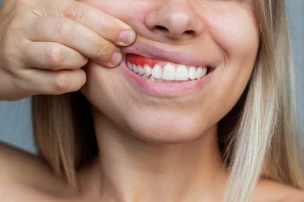Как восстановить эмаль зубов?