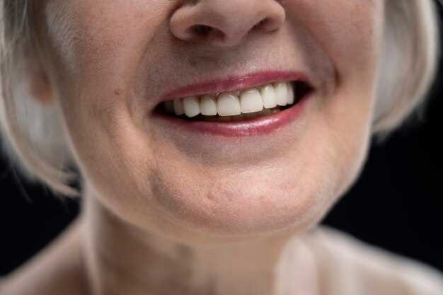 Заболевания, вызывающие изменение зубной эмали