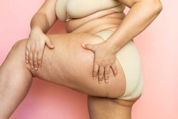 Причины жировой эмболии